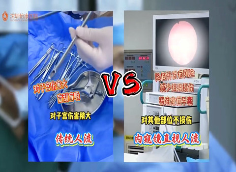 藥物流產vs無痛人流：費用、過程、最佳時間全面對比