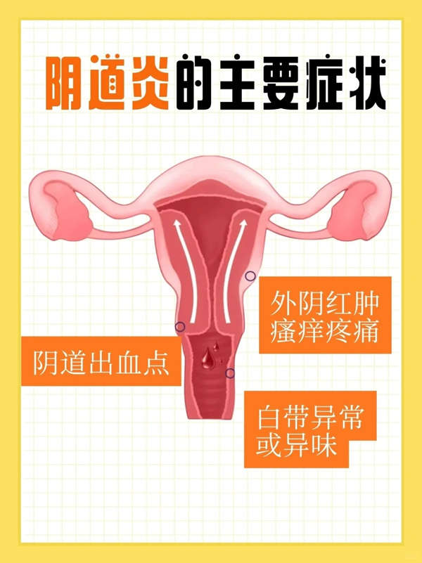 陰道炎的治療方法-私處有異味是陰道炎嗎？
