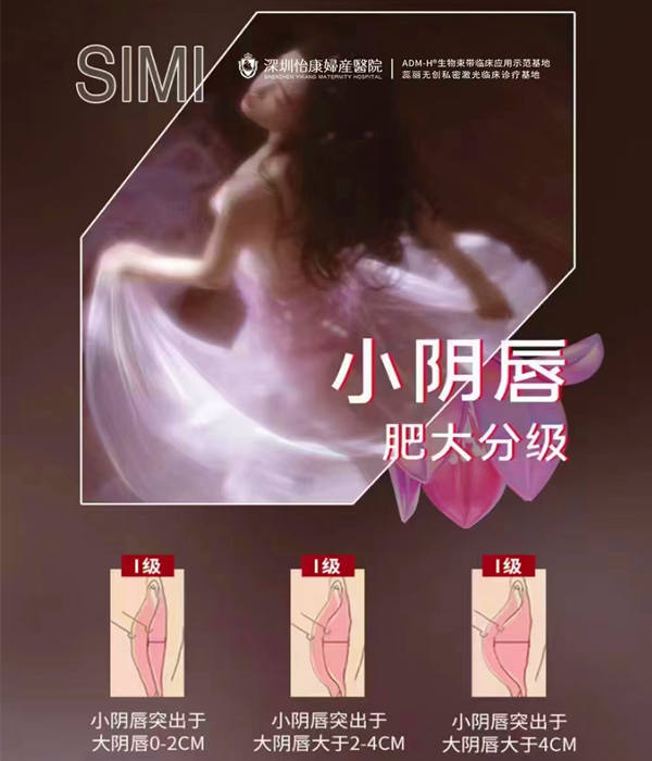 深圳小陰唇手術費用-香港小陰唇手術費用